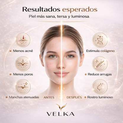 Máscara LED Facial VELKA™